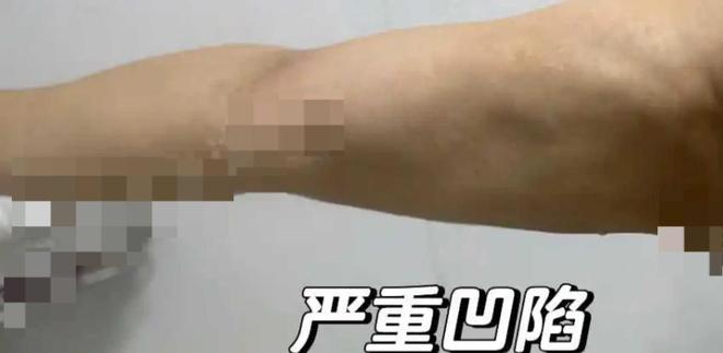 皮肤管理艺星品牌成赞扬“大户”深圳艺星医疗美容病院被记者起底！(图6)